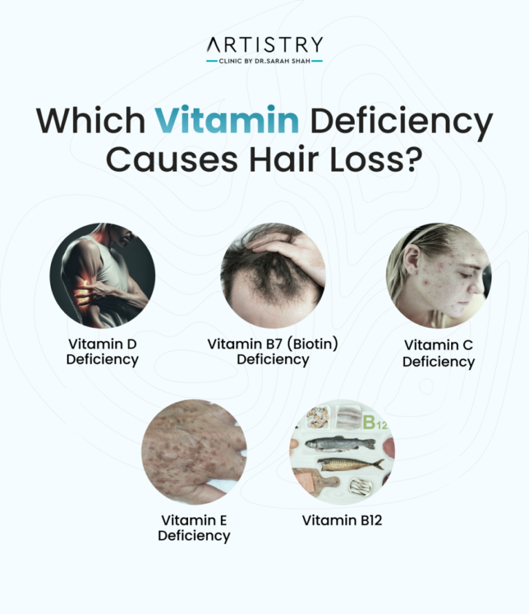 Hair Fall Due to Vitamin Deficiency: Complete Guide